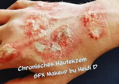 SFX Makeup, chronisches Handekzem I Maskenbildnerin & Visagistin Heidi Debbah